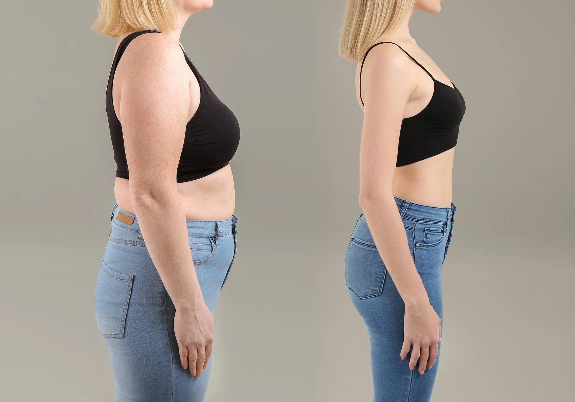 Weight-Loss-Concept-Before-and-After